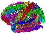 brainscan.png image by memetherapy